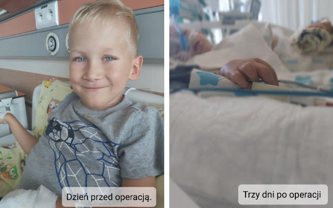 By nigdy nie zabrakło wiary w lepsze jutro! Nathan potrzebuje naszej pomocy!-2