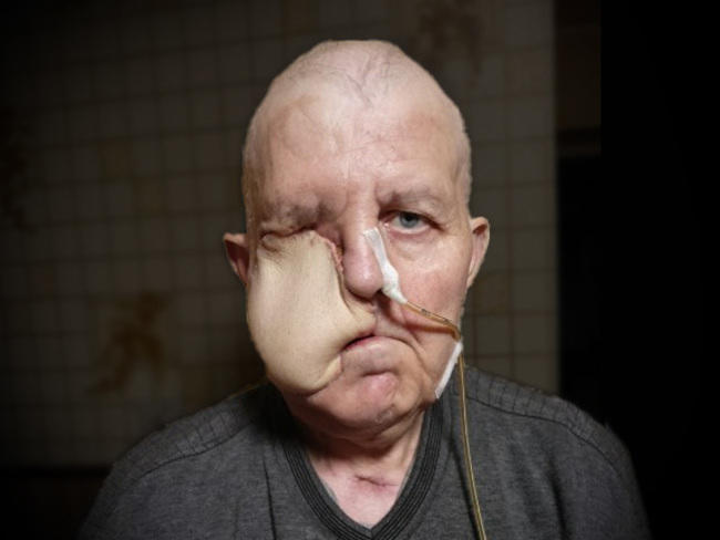 Wiesław ma chroniczny ból zęba-1